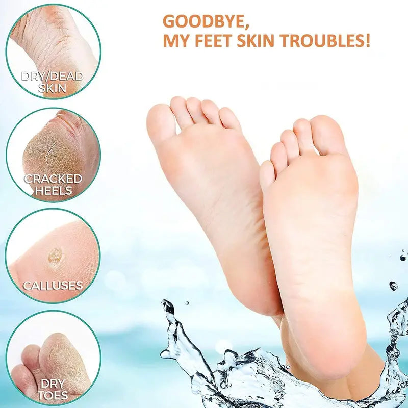 Kit de soin des pieds anti-callosités électrique avec aspirateur