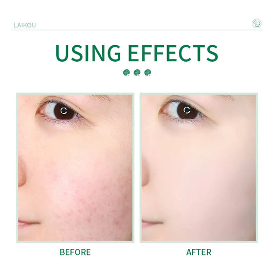 Nettoyant visage Centella Asiatica 50g pour les pores